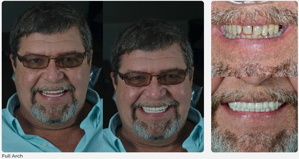 collage1